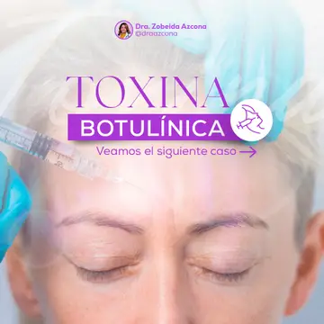 Pieza 4 del feed de Dra. Zobeida Azcona